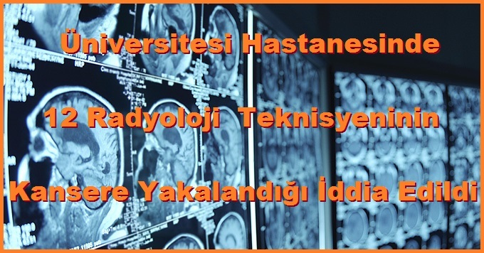 Erciyes Üniversitesi Hastanesinde 12 Radyoloji ( Tıbbi Görüntüleme ) Teknisyeninin Kansere Yakalandığı İddia Edildi